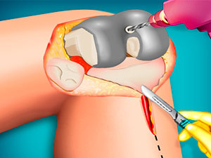 Jogue Simulador de Cirurgia do Joelho jogo online grátis