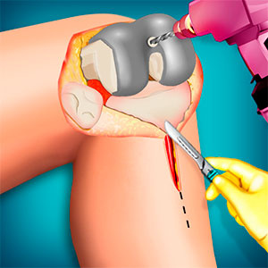 Jogar Operate Now Cirurgia no Joelho no