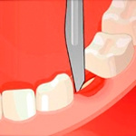 Лікувати зуби